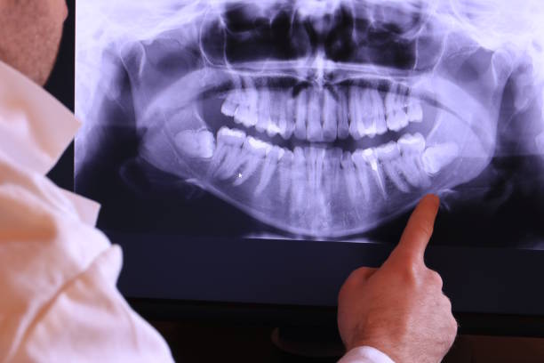 Best Knocked-Out Tooth Emergency  in Seabrook Island, SC