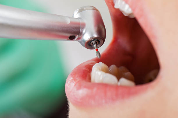Emergency Dentist Open Today in SC